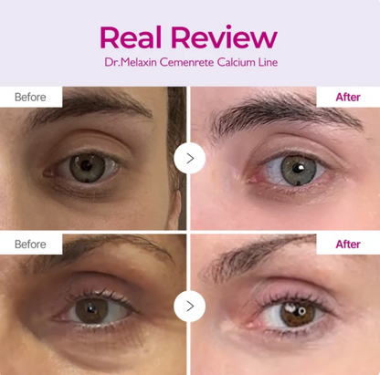 Cemenrete Calcium Eyecare Routine